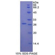 SDS-PAGE analysis of Human TIGIT Protein.