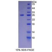 SDS-PAGE analysis of recombinant Rat TIGIT Protein.