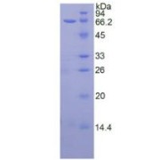 SDS-PAGE analysis of recombinant Human TERT Protein.