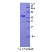 SDS-PAGE analysis of Rat TERT Protein.