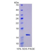 SDS-PAGE analysis of Rat Thioredoxin Protein.