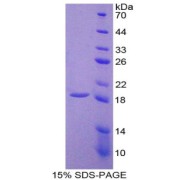 SDS-PAGE analysis of Rat Thrombomodulin Protein.