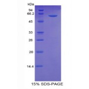 SDS-PAGE analysis of recombinant Human Thrombospondin 4 Protein.