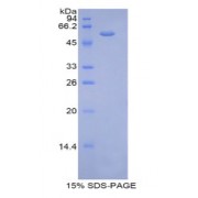SDS-PAGE analysis of Mouse Thrombospondin 4 Protein.