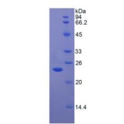 SDS-PAGE analysis of Human TP Protein.