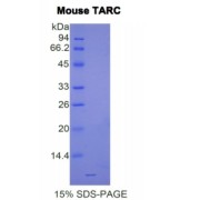 SDS-PAGE analysis of Mouse TARC Protein.