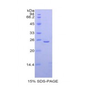 SDS-PAGE analysis of Mouse Thyroid Peroxidase Protein.