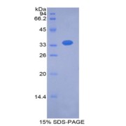 SDS-PAGE analysis of Human TBG Protein.