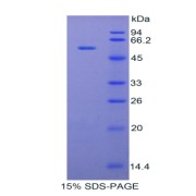 SDS-PAGE analysis of recombinant Rabbit TFPI Protein.