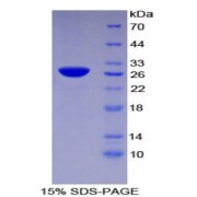 SDS-PAGE analysis of Human TFPI2 Protein.