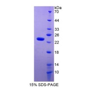 SDS-PAGE analysis of Rat TIMP1 Protein.