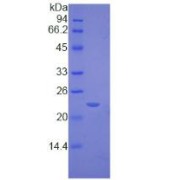 SDS-PAGE analysis of Mouse TIMP2 Protein.