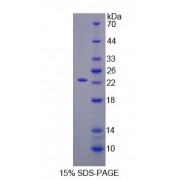 SDS-PAGE analysis of Rat TIMP2 Protein.