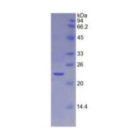 SDS-PAGE analysis of Mouse TIMP4 Protein.