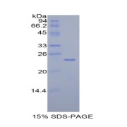 SDS-PAGE analysis of Rat TIMP4 Protein.