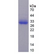 SDS-PAGE analysis of Human TRADD Protein.