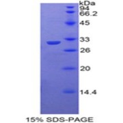 SDS-PAGE analysis of Mouse TOLLIP Protein.