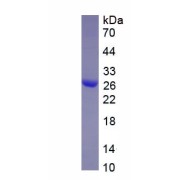 SDS-PAGE analysis of recombinant Human Toll Like Receptor 2 (TLR2) Protein.