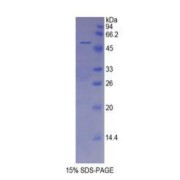 SDS-PAGE analysis of Rat Toll Like Receptor 2 Protein.