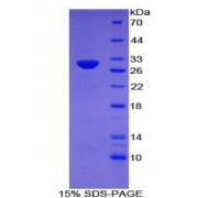 SDS-PAGE analysis of Mouse Toll Like Receptor 6 Protein.