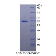 SDS-PAGE analysis of Human TICAM2 Protein.