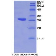 SDS-PAGE analysis of Mouse TOR1AIP2 Protein.