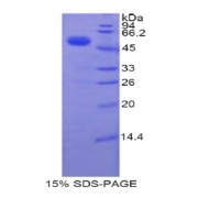 SDS-PAGE analysis of Human TFAM Protein.