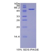 SDS-PAGE analysis of Rat TFAM Protein.