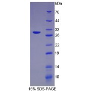 SDS-PAGE analysis of Mouse Transferrin Protein.