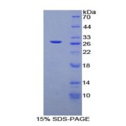 SDS-PAGE analysis of Rat TGFb1I1 Protein.