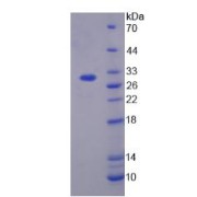 SDS-PAGE analysis of Human TGFbI Protein.