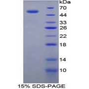 SDS-PAGE analysis of Rat TGM1 Protein.