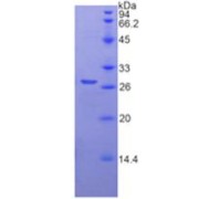 SDS-PAGE analysis of recombinant Human TMPRSS2 Protein.