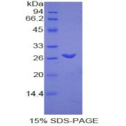 SDS-PAGE analysis of Rat TMEM173 Protein.