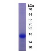 SDS-PAGE analysis of recombinant Rat Transthyretin Protein.