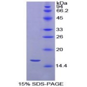 SDS-PAGE analysis of recombinant Chicken Transthyretin Protein.