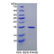 SDS-PAGE analysis of Dog Transthyretin Protein.