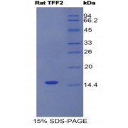 SDS-PAGE analysis of Rat Trefoil Factor 2 Protein.