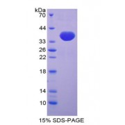 SDS-PAGE analysis of Mouse TFF3 Protein.