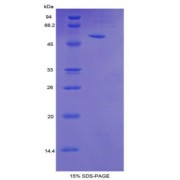 SDS-PAGE analysis of Mouse TFF3 Protein.