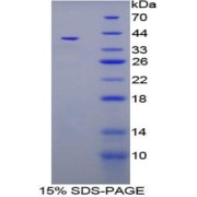 SDS-PAGE analysis of Human TFF3 Protein.