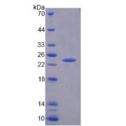 SDS-PAGE analysis of Human TNNI1 Protein.