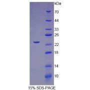 SDS-PAGE analysis of Rat TNNI1 Protein.