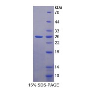 SDS-PAGE analysis of recombinant Mouse TNNI2 Protein.