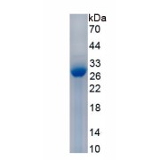 SDS-PAGE analysis of recombinant Rat Troponin I Type 3, Cardiac Protein.