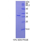 SDS-PAGE analysis of Rat TNNT1 Protein.
