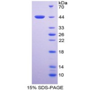 SDS-PAGE analysis of Human TNNT2 Protein.