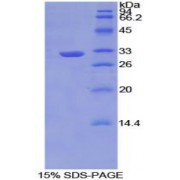 SDS-PAGE analysis of Mouse TNIP2 Protein.