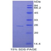 SDS-PAGE analysis of Rat TNIP2 Protein.