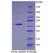 SDS-PAGE analysis of recombinant Human TNFB/LTA Protein.